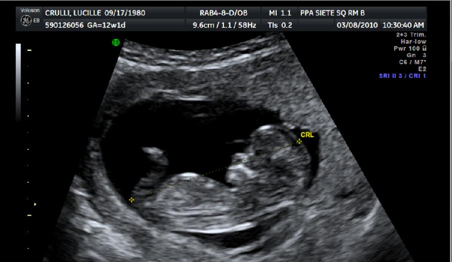 12 Week Ultrasound | We're Havin' A Baby!!!!!!